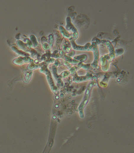 Image of Botryobasidium subcoronatum (Höhn. & Litsch.) Donk 1931