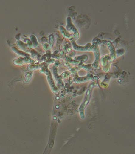 Botryobasidium subcoronatum (Höhn. & Litsch.) Donk 1931 resmi