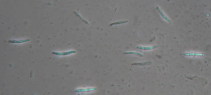 Image of Subulicystidium longisporum (Pat.) Parmasto 1968