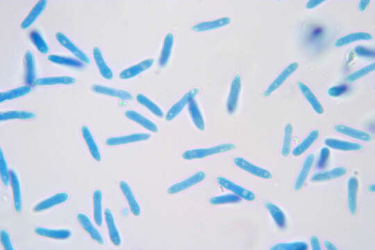 Image of Pyrenopeziza brassicae B. Sutton & Rawl. 1979