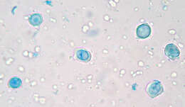 Image of Entyloma microsporum J. Schröt. 1874