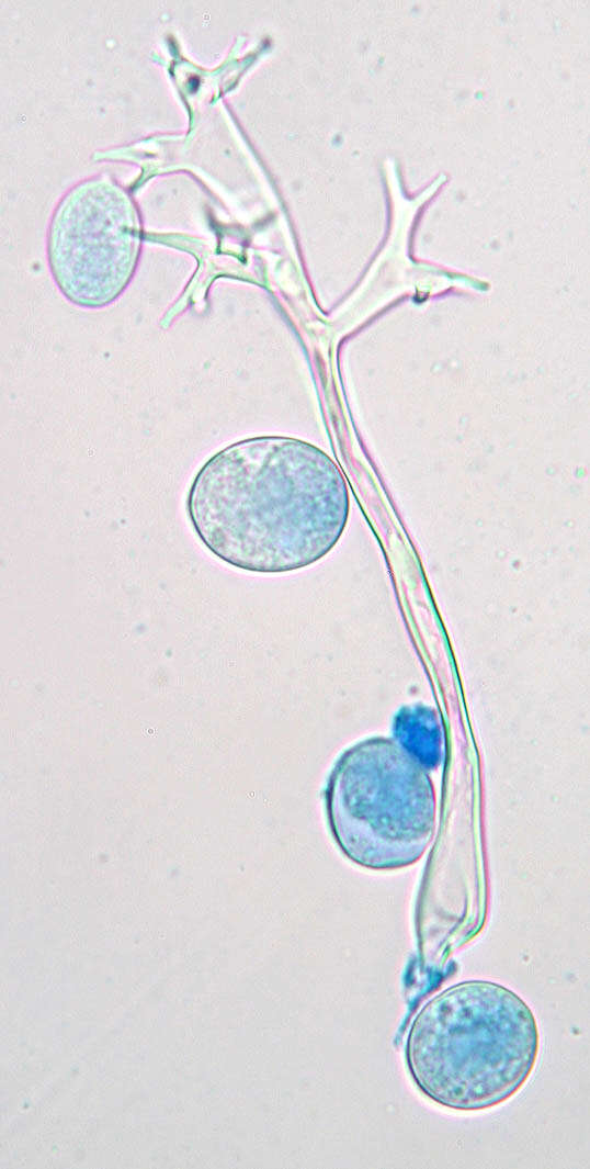 Image of Plasmopara chaerophylli