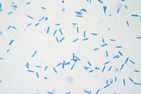 صورة Spermosporina aricola U. Braun 1993