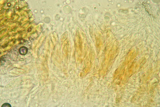 Image of Colletotrichum gloeosporioides (Penz.) Penz. & Sacc. 1884