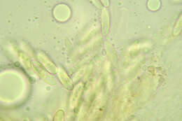 Image of Colletotrichum gloeosporioides (Penz.) Penz. & Sacc. 1884