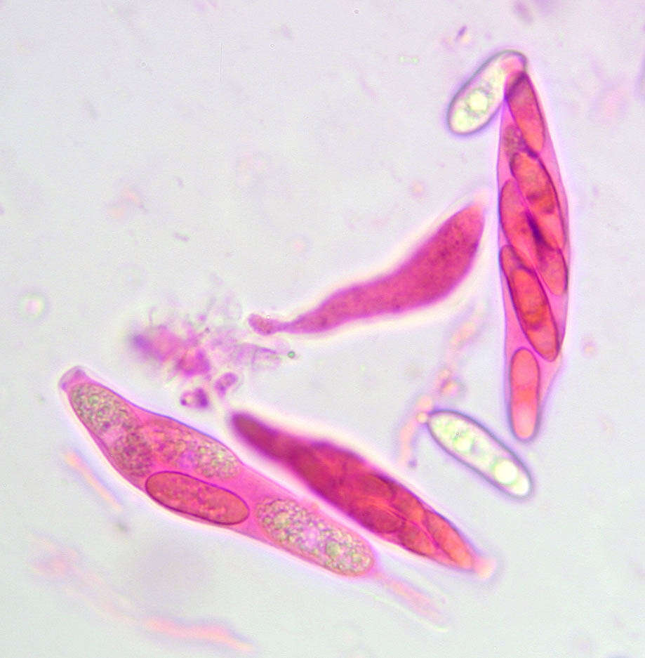 Image of Colletotrichum gloeosporioides (Penz.) Penz. & Sacc. 1884