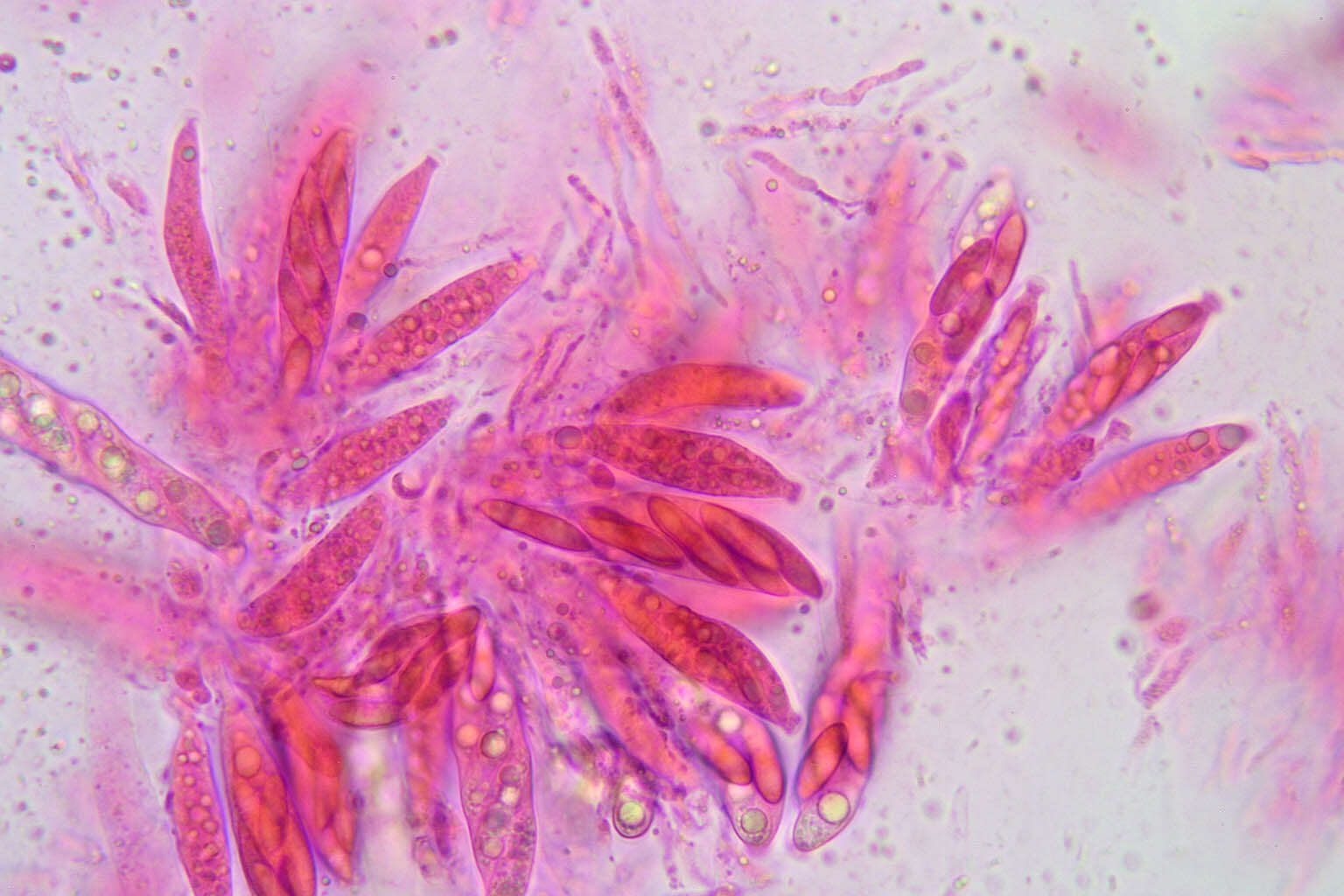 Image of Colletotrichum gloeosporioides (Penz.) Penz. & Sacc. 1884