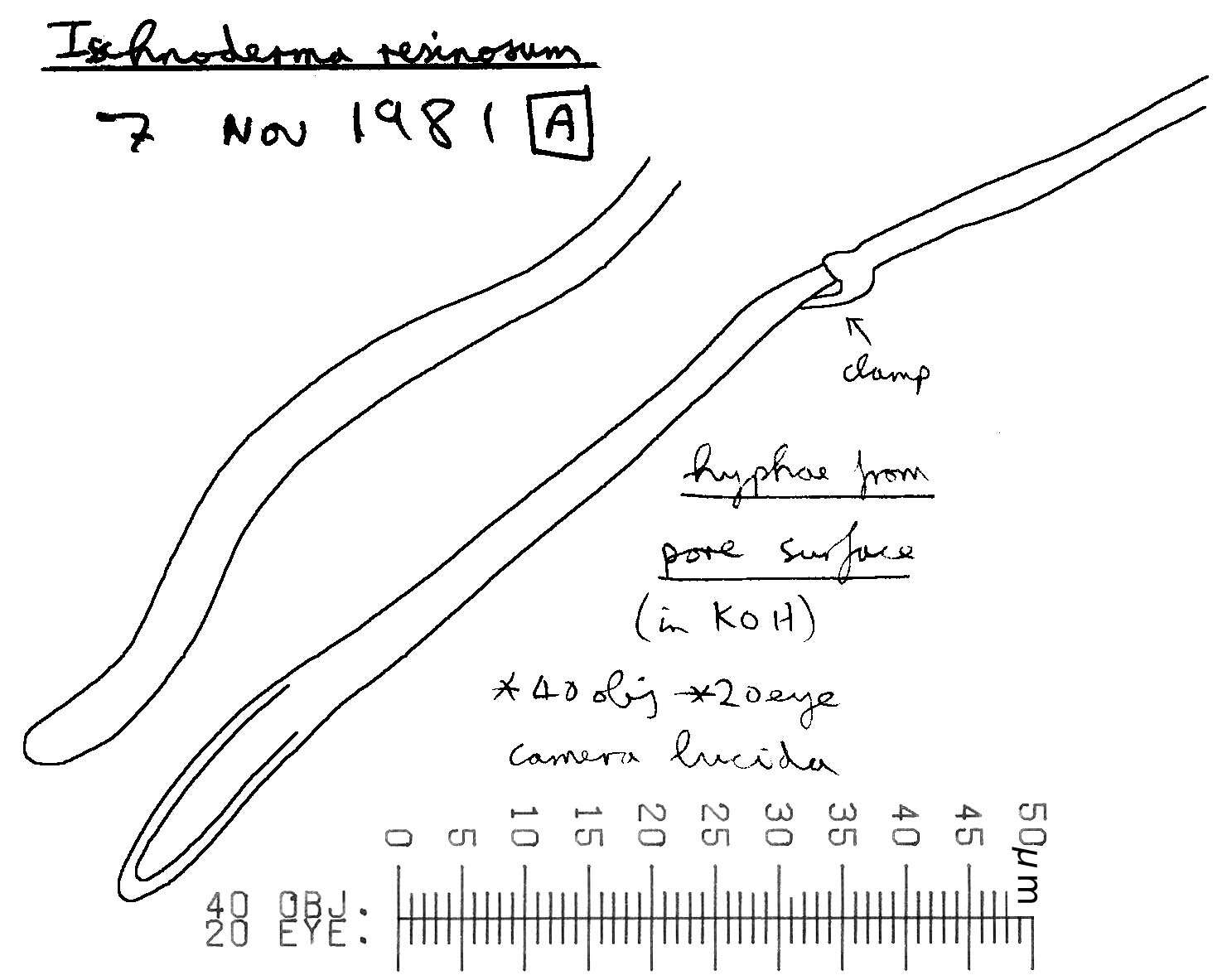 Image of Benzoin Bracket