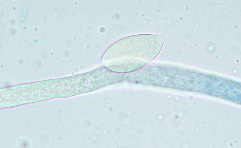 Image of Phytophthora de Bary 1876