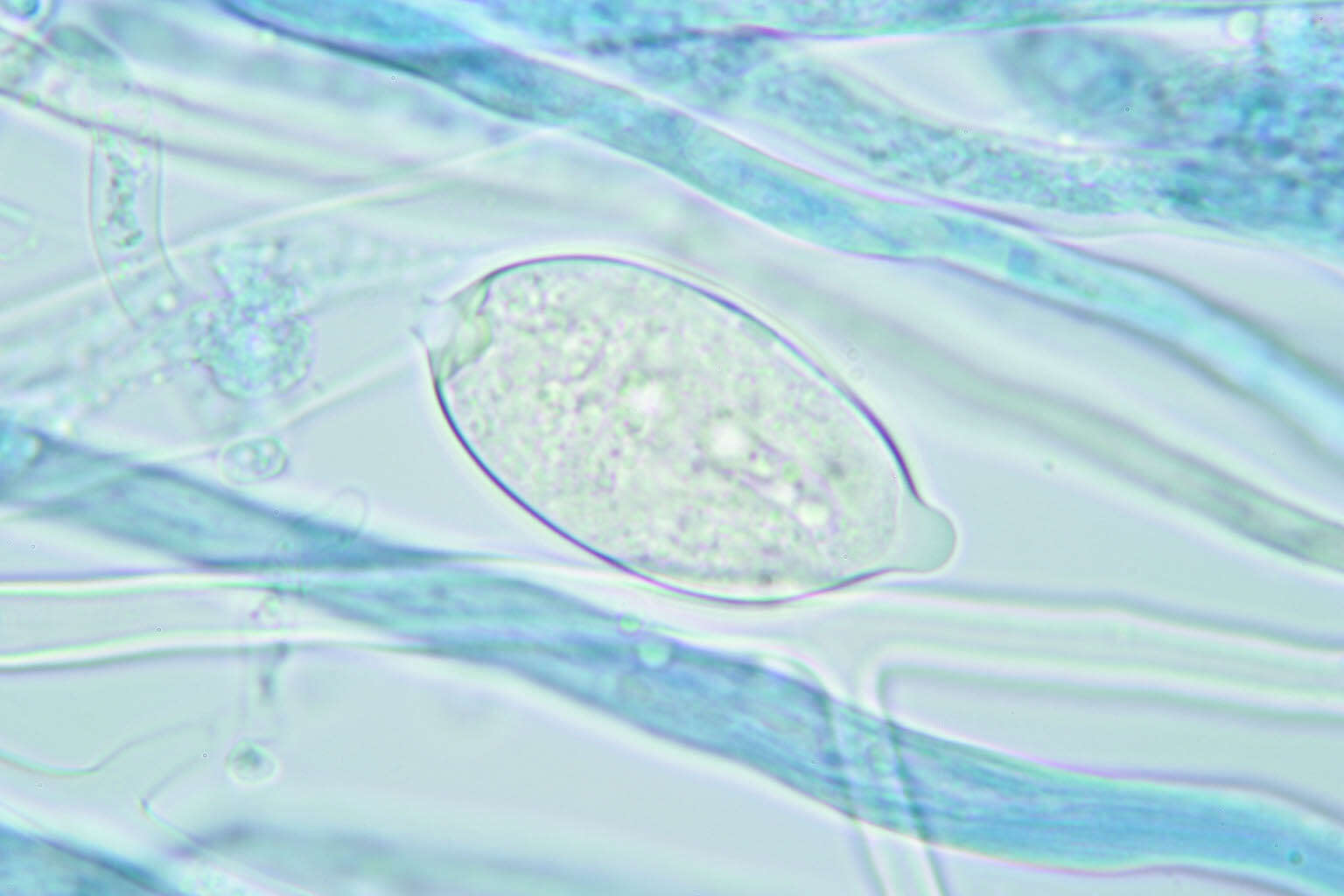 Image of Phytophthora de Bary 1876