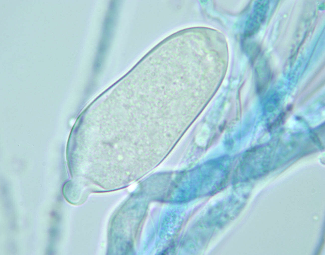 Image of Phytophthora de Bary 1876