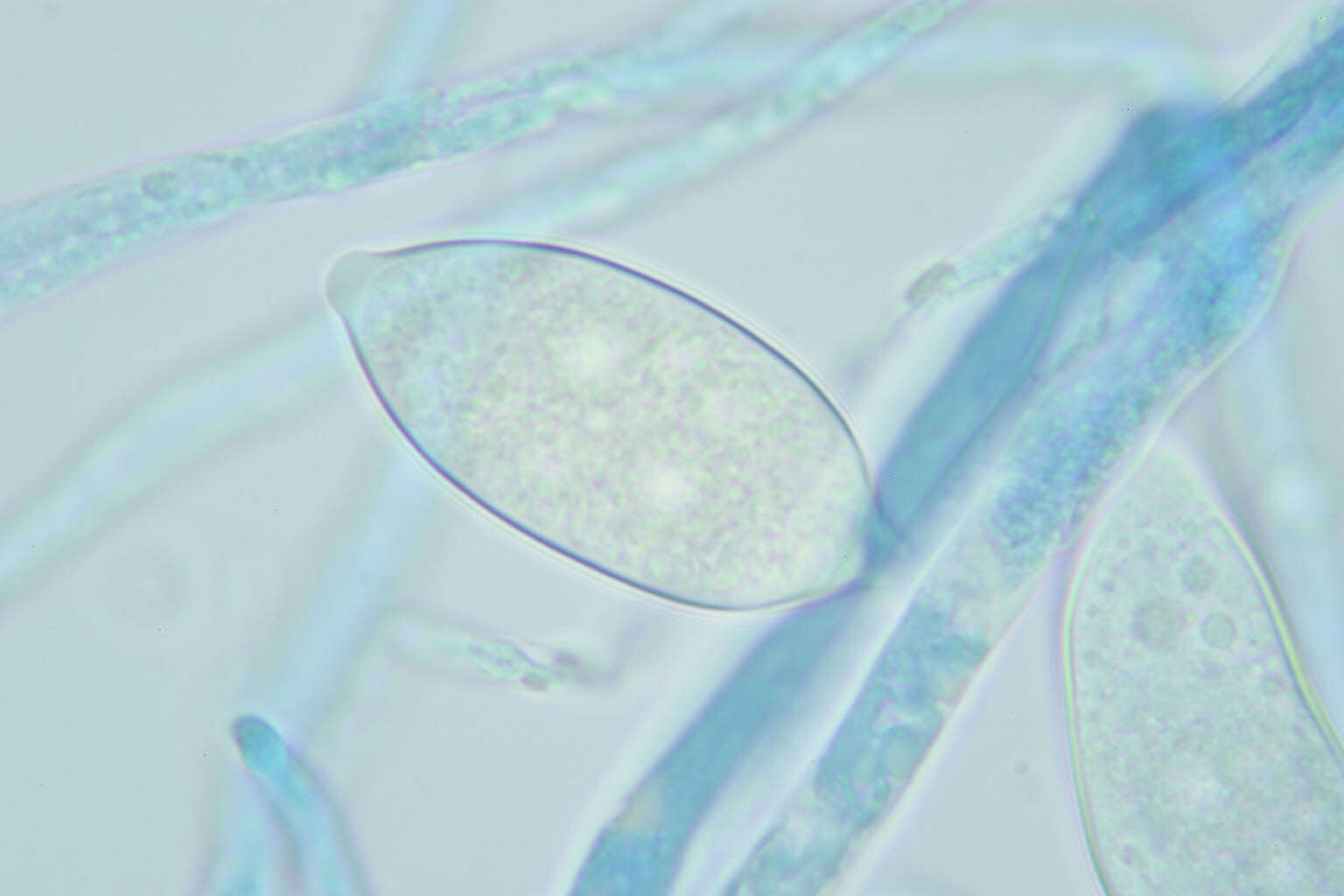 Image of Phytophthora de Bary 1876