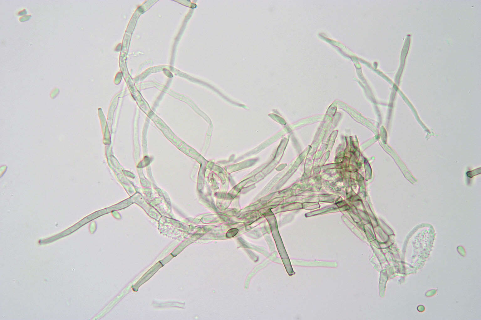 Image of Cladosporium uredinicola Speg. 1912