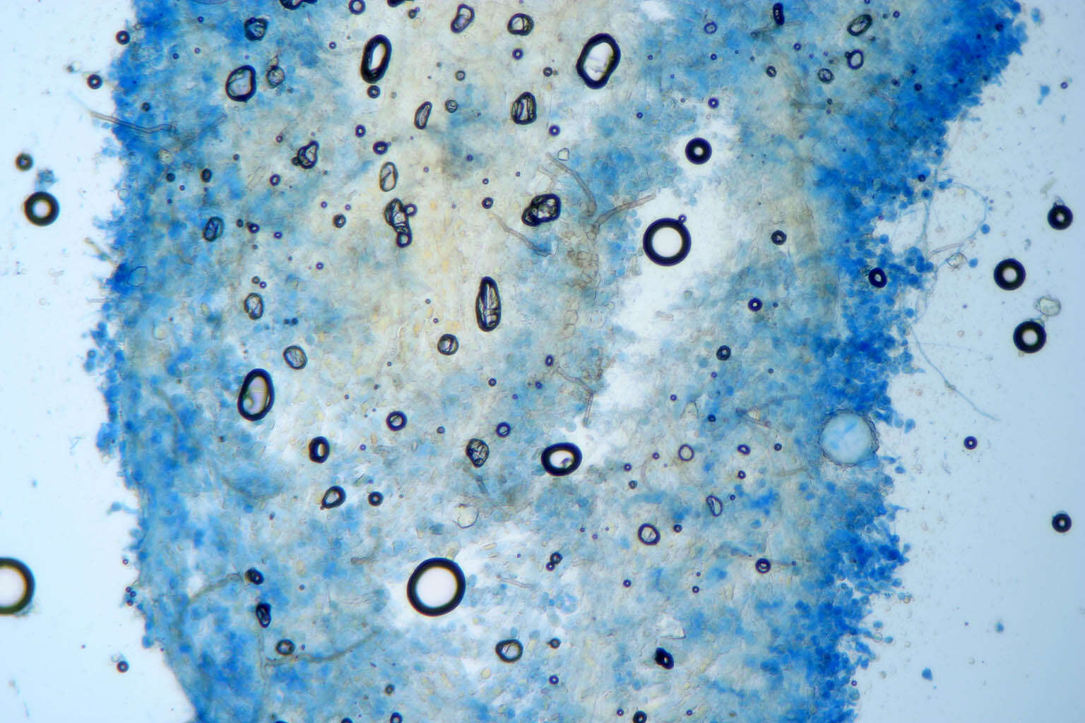 Image of White-pine blister rust