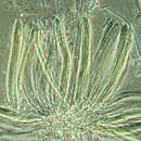 Image of Cyclaneusma needle cast