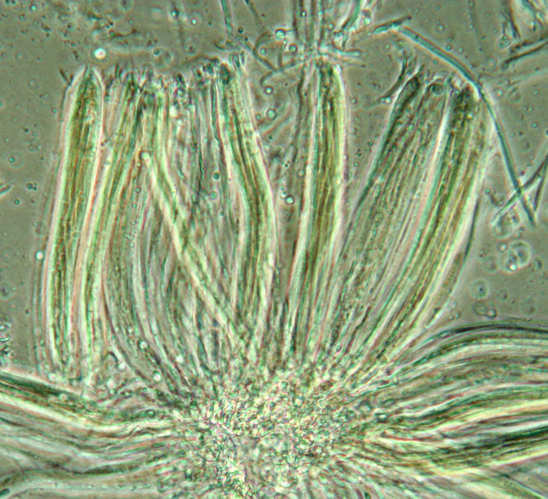 Image of Cyclaneusma needle cast