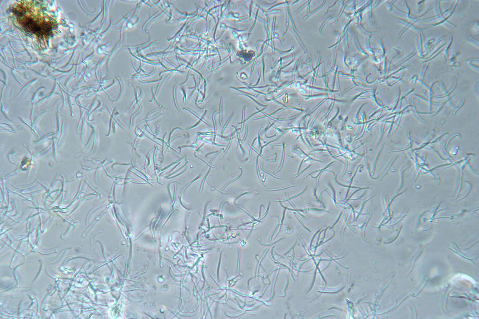 Plancia ëd Phomopsis araucariae Grove 1935