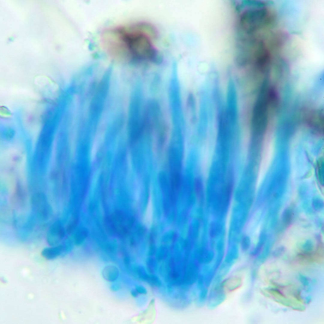 Sivun Diaporthe juniperivora (G. G. Hahn) Rossman & Udayanga 2015 kuva