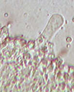 Image of Rickenella swartzii (Fr.) Kuyper 1984