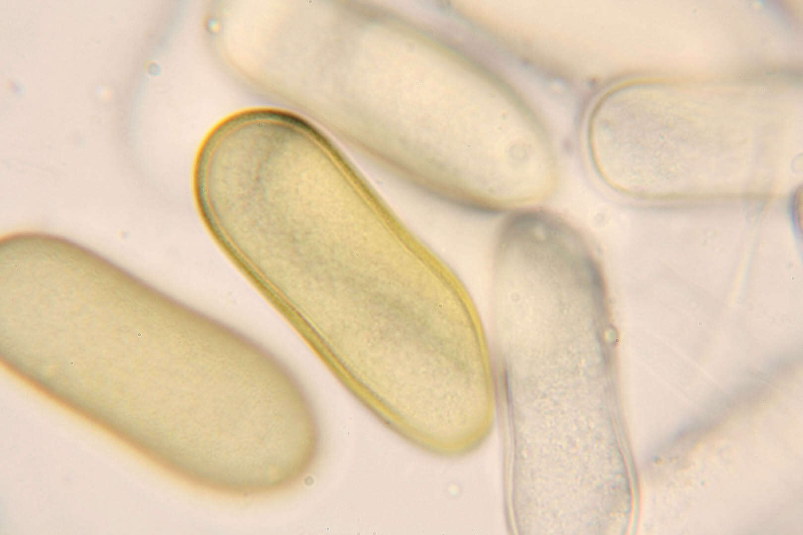 Phaeobotryosphaeria resmi