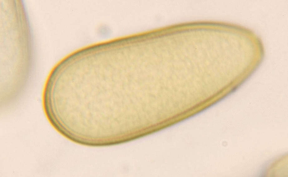 Phaeobotryosphaeria resmi