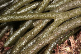 Image of dead man's fingers