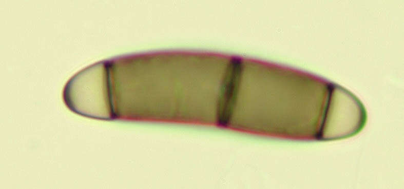 Imagem de Chaetosphaerella phaeostroma (Durieu & Mont.) E. Müll. & C. Booth 1972