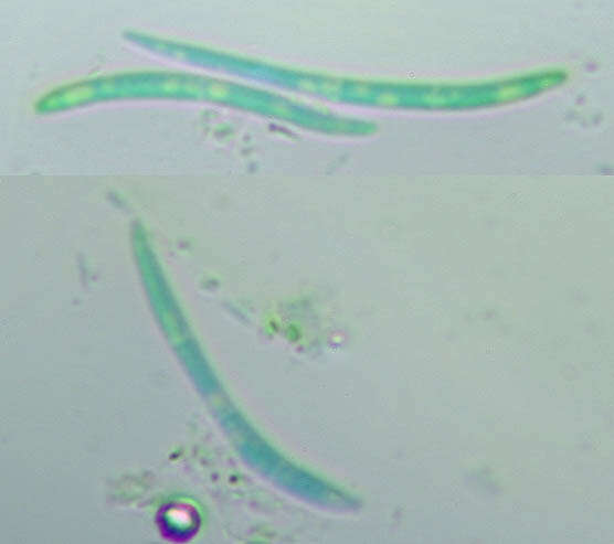 Image of Septoria hydrocotyles Desm. 1842