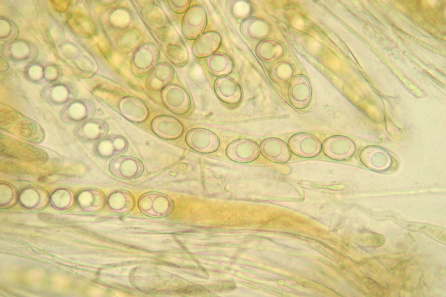 Image of Trichophaea woolhopeia (Cooke & W. Phillips) Boud. 1885