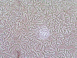 Image of Chlorociboria aeruginascens (Nyl.) Kanouse ex C. S. Ramamurthi, Korf & L. R. Batra 1958