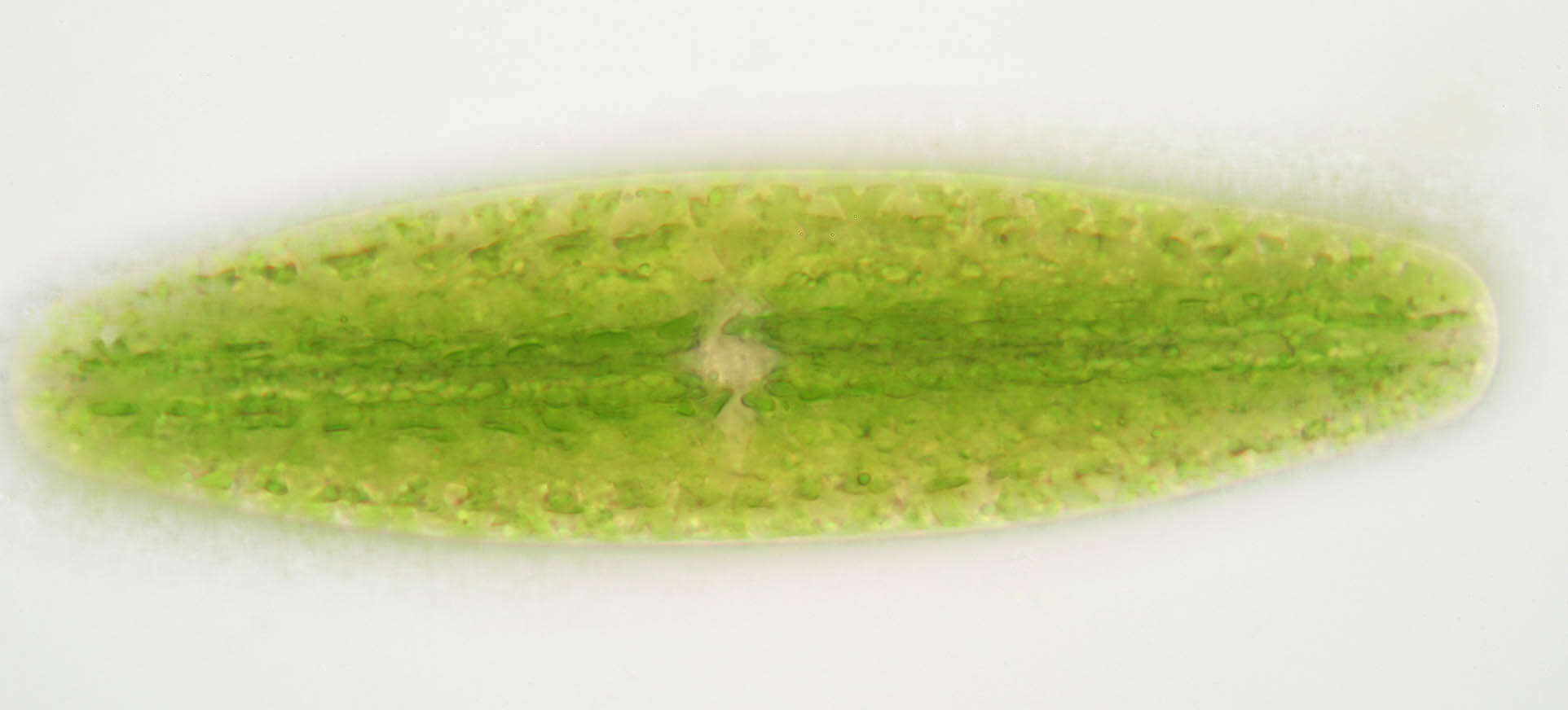 Image of Netrium digitus