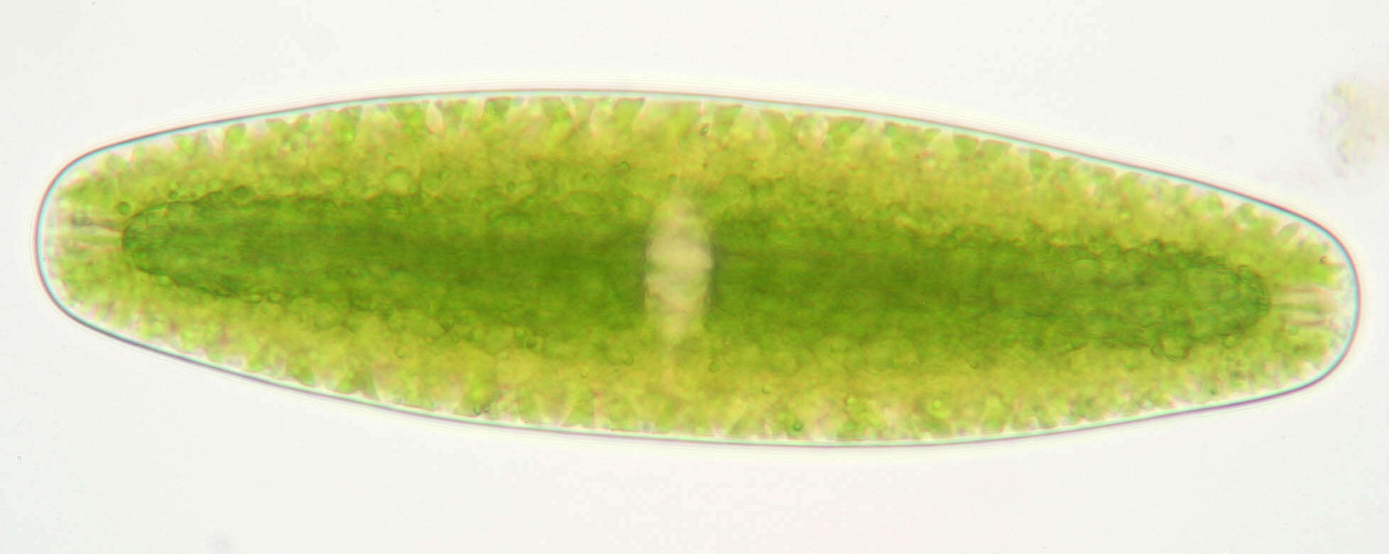 Image of Netrium digitus