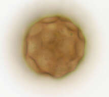 Image of Arcella gibbosa