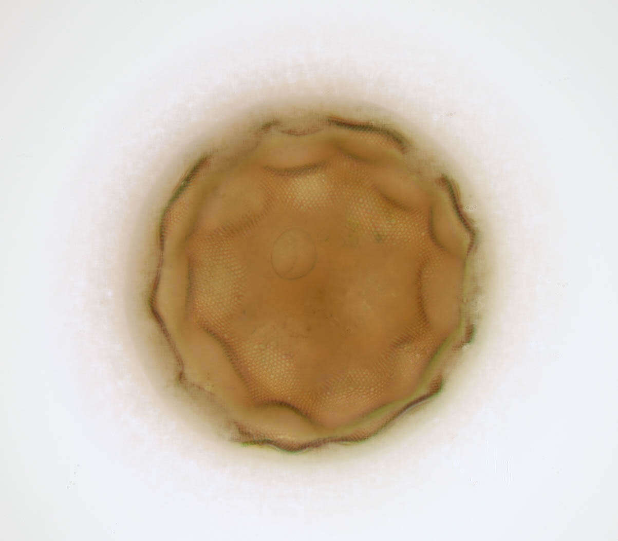 Image of Arcella gibbosa