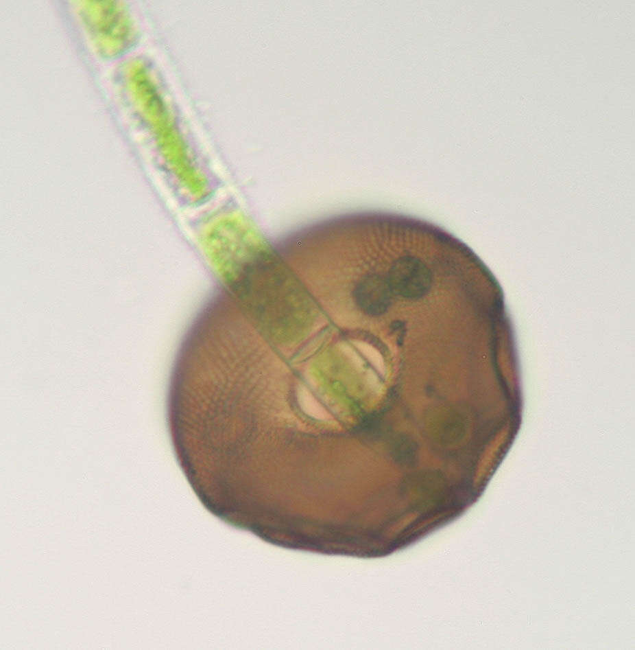 Image of Arcella gibbosa