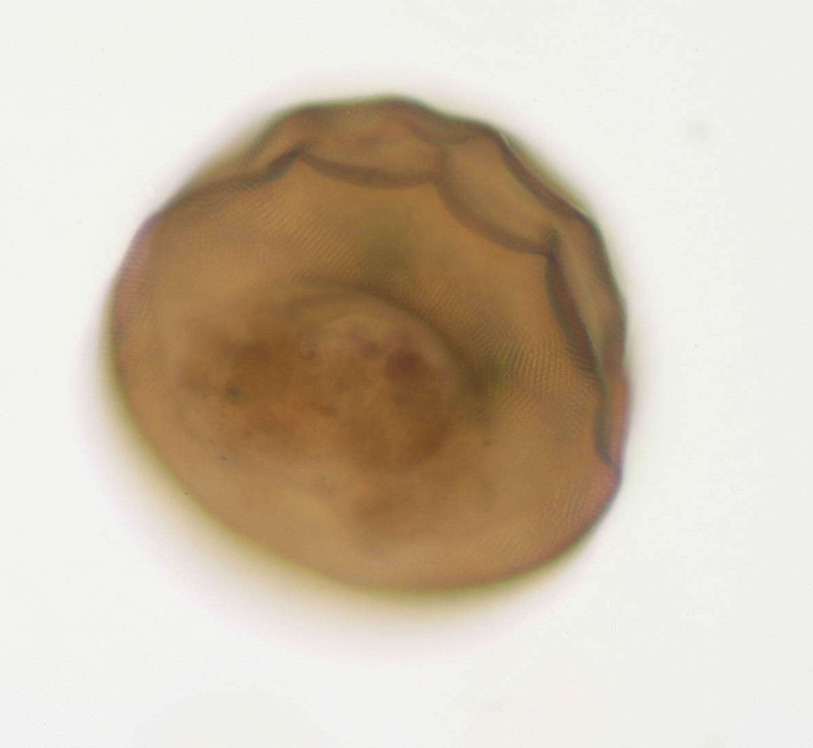 Image of Arcella gibbosa