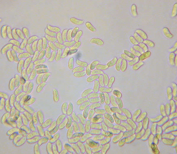 Imagem de Calocera viscosa (Pers.) Fr. 1821