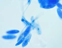 Image of Erynia radicans (Bref.) Humber, Ben Ze'ev & R. G. Kenneth 1981
