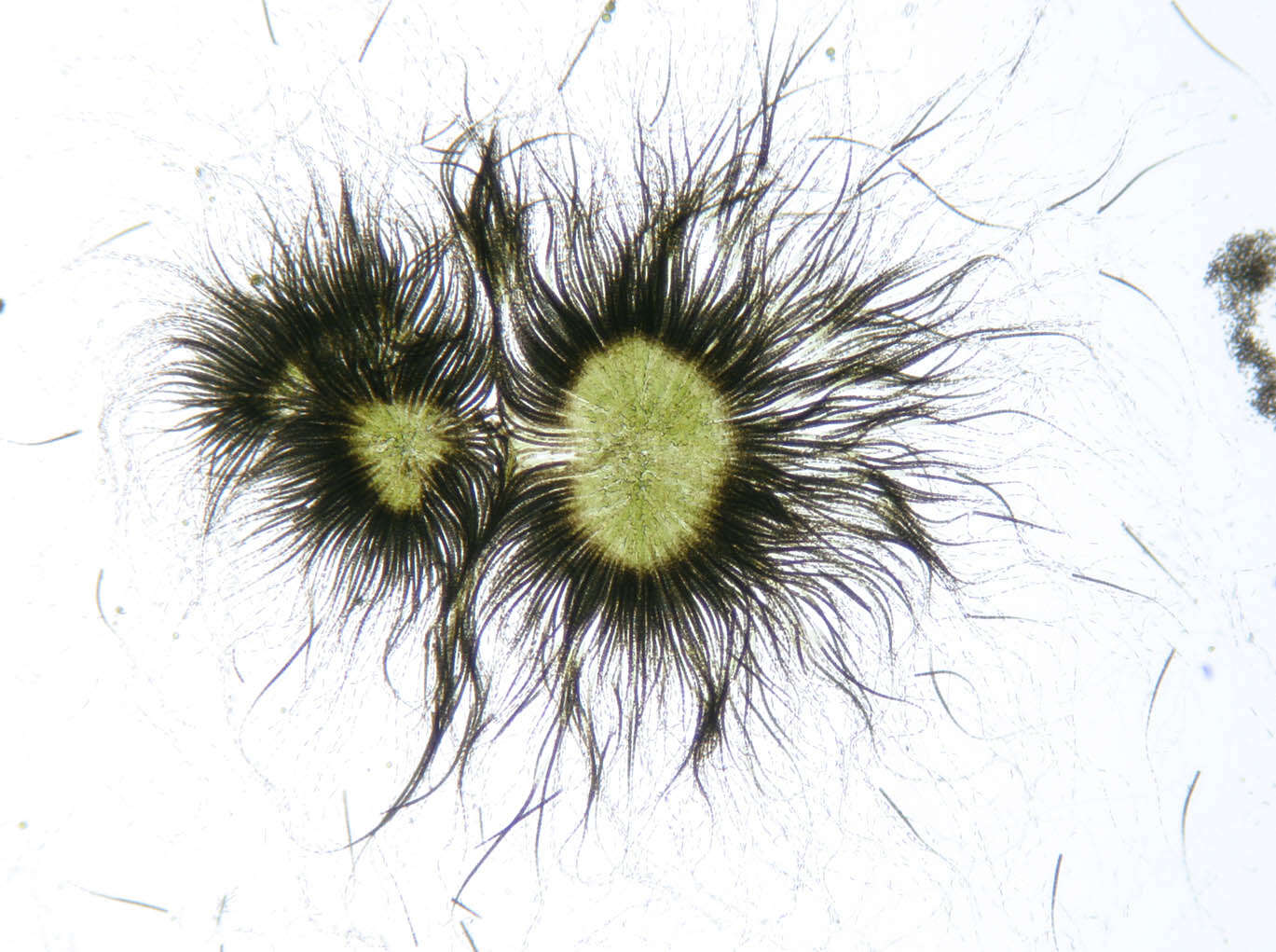 Image of Gloeotrichia echinulata