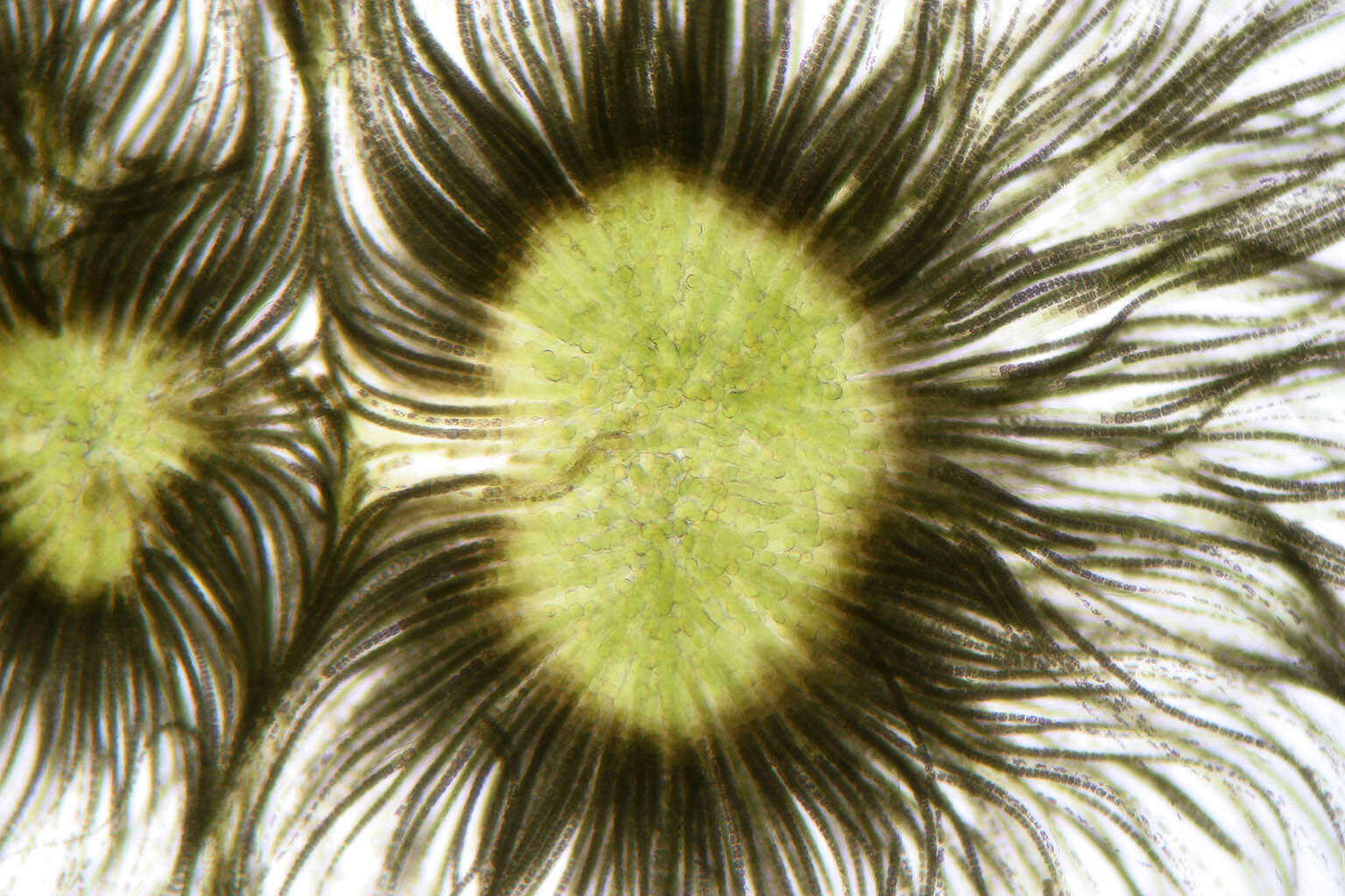 Image of Gloeotrichia echinulata