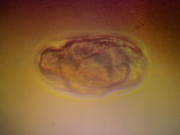 Image of <i>Syngamus trachea</i>
