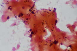 Image of unclassified Saccharomycetales