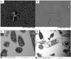 Image of Gammaproteobacteria