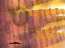 Image of oncophorus moss