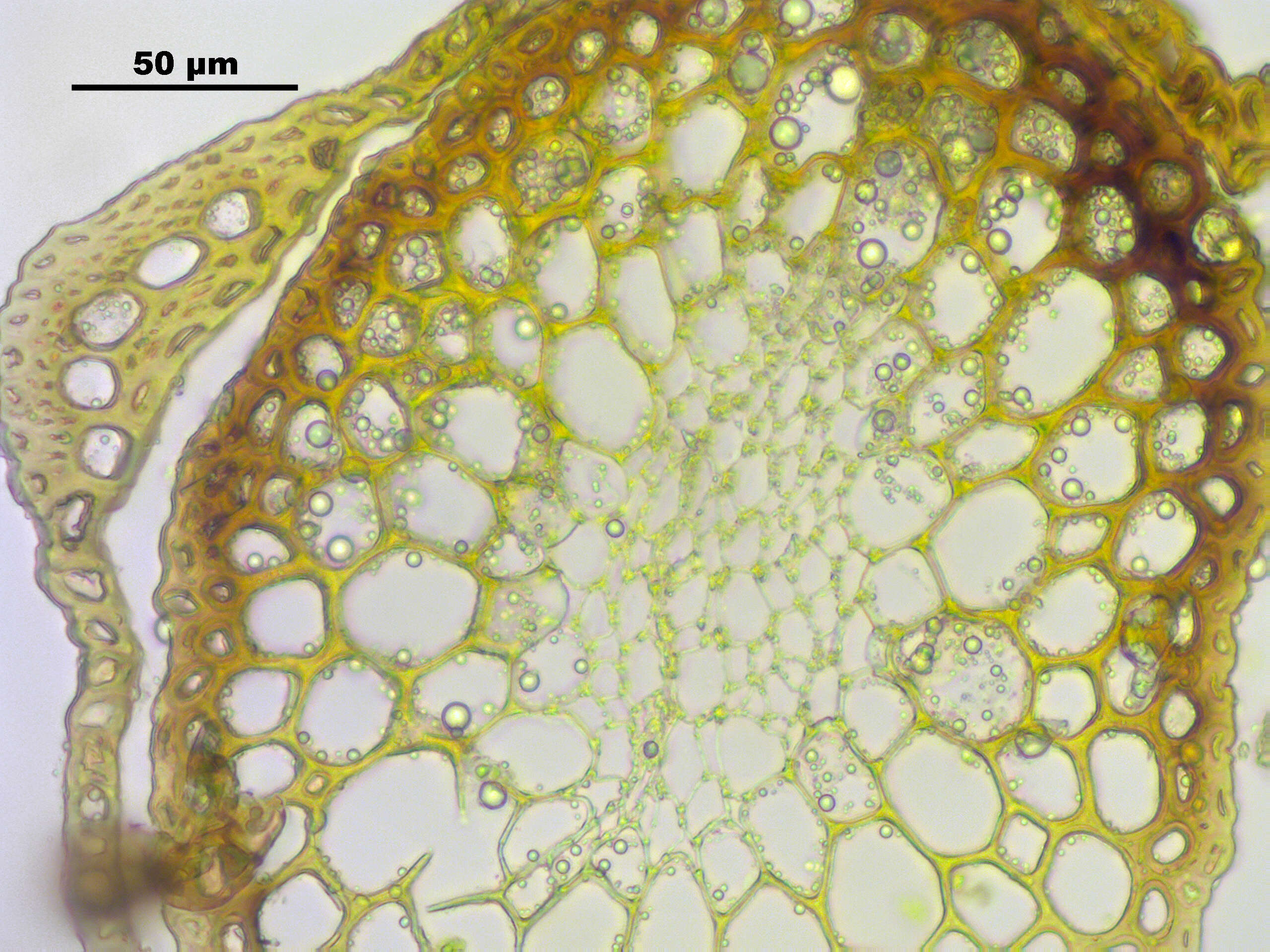 Image of oncophorus moss