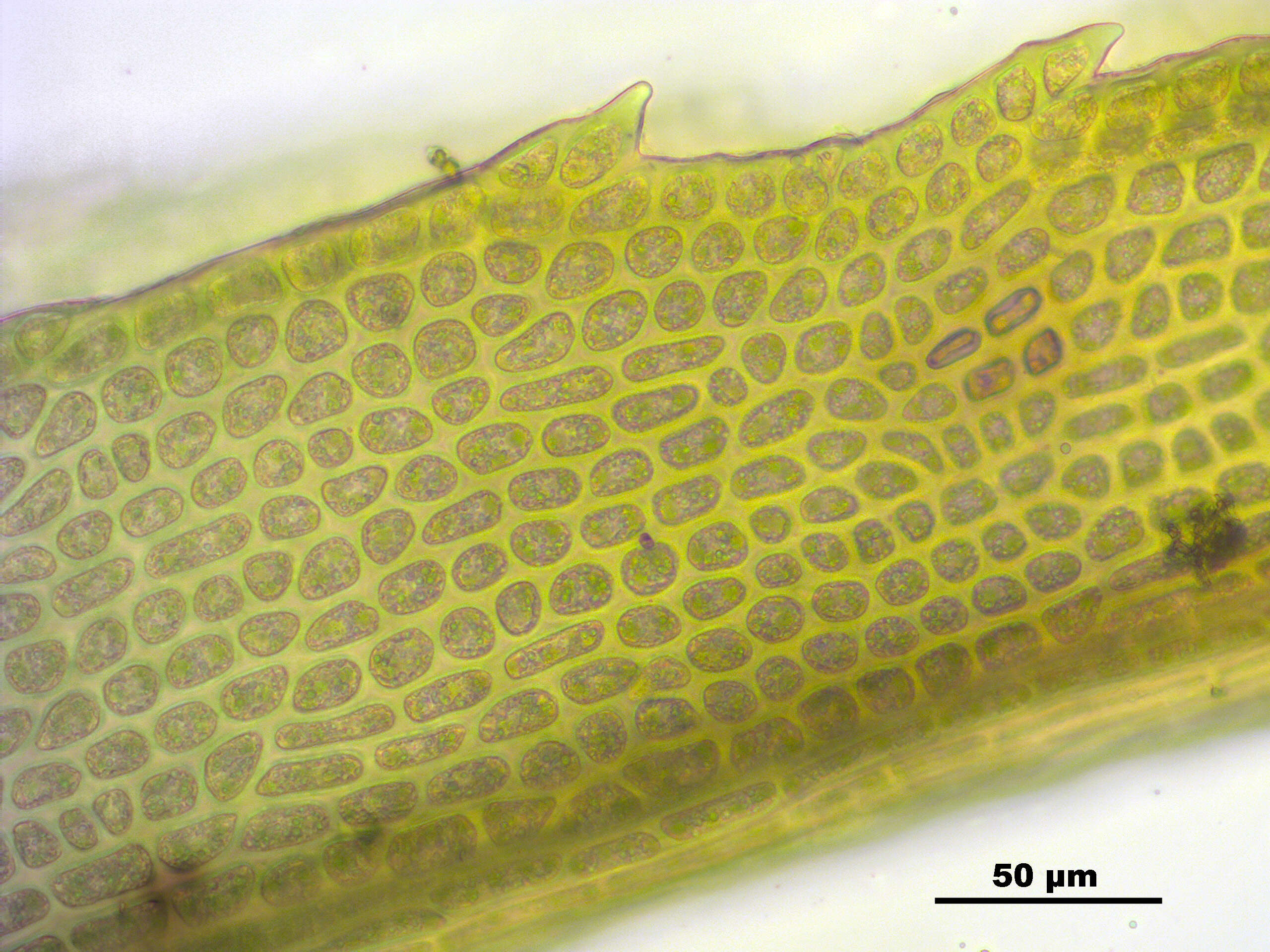 Image of oncophorus moss