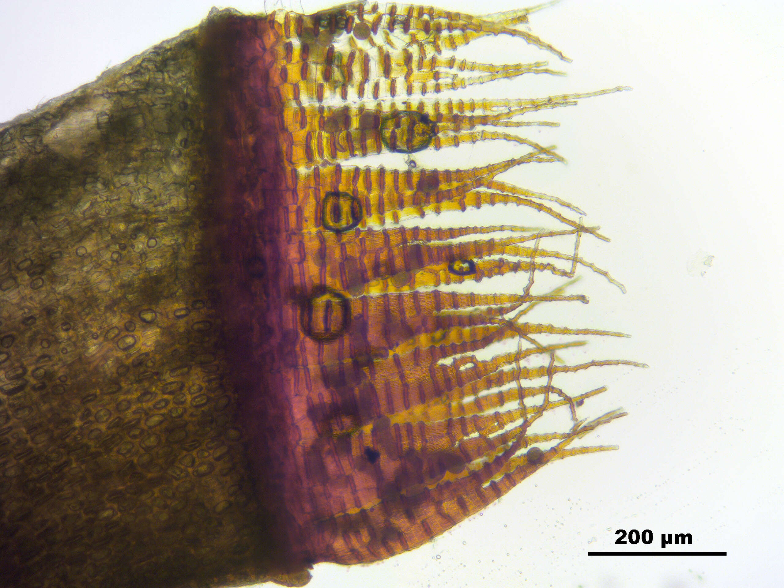 Image of oncophorus moss