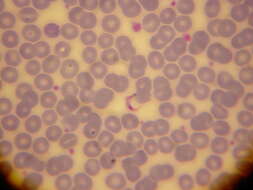 Image of Trypanosoma subgen. Schizotrypanum