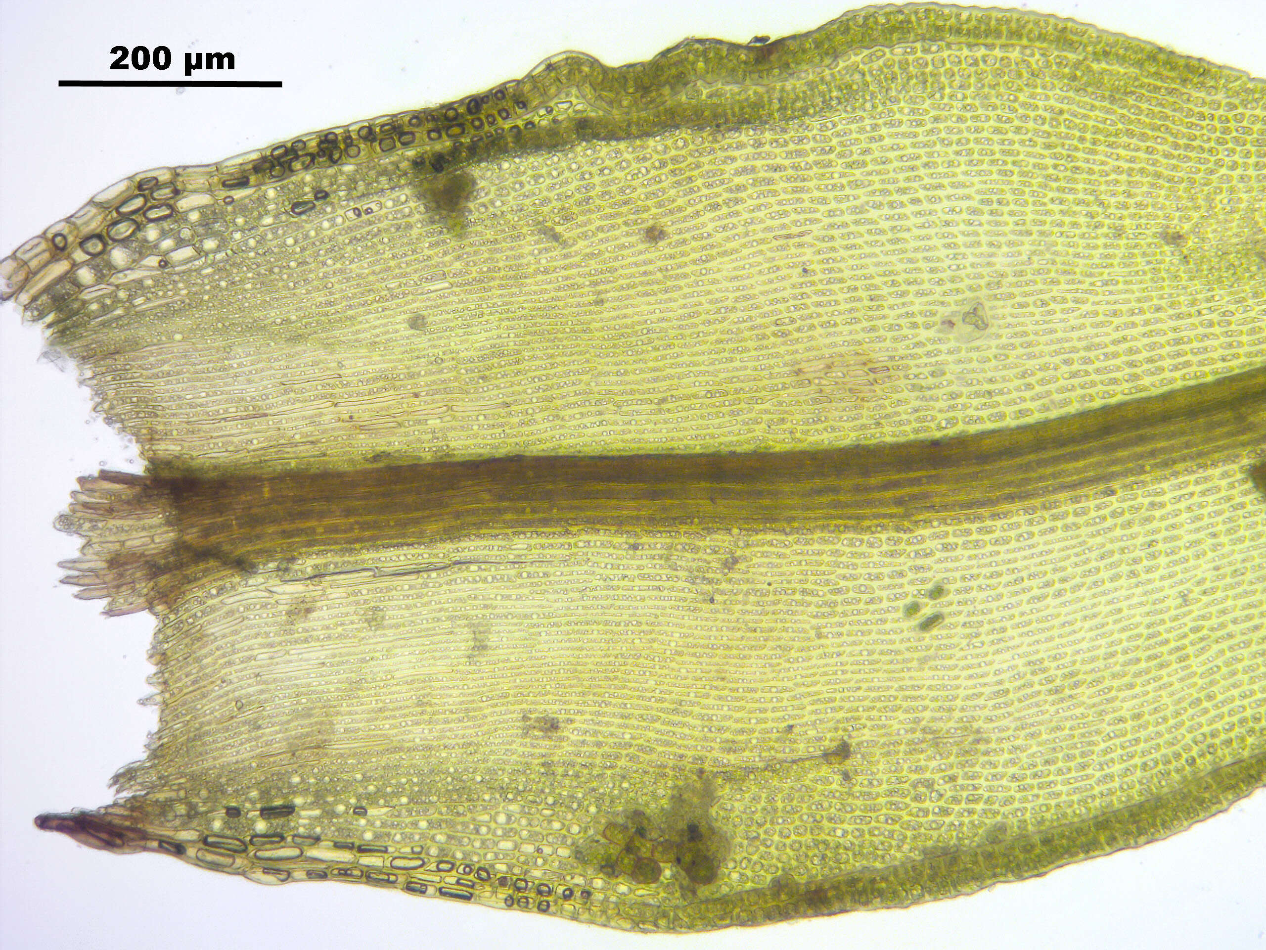 Image of oncophorus moss