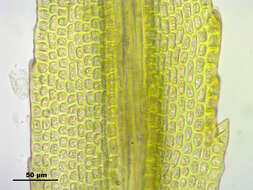 Image of oncophorus moss